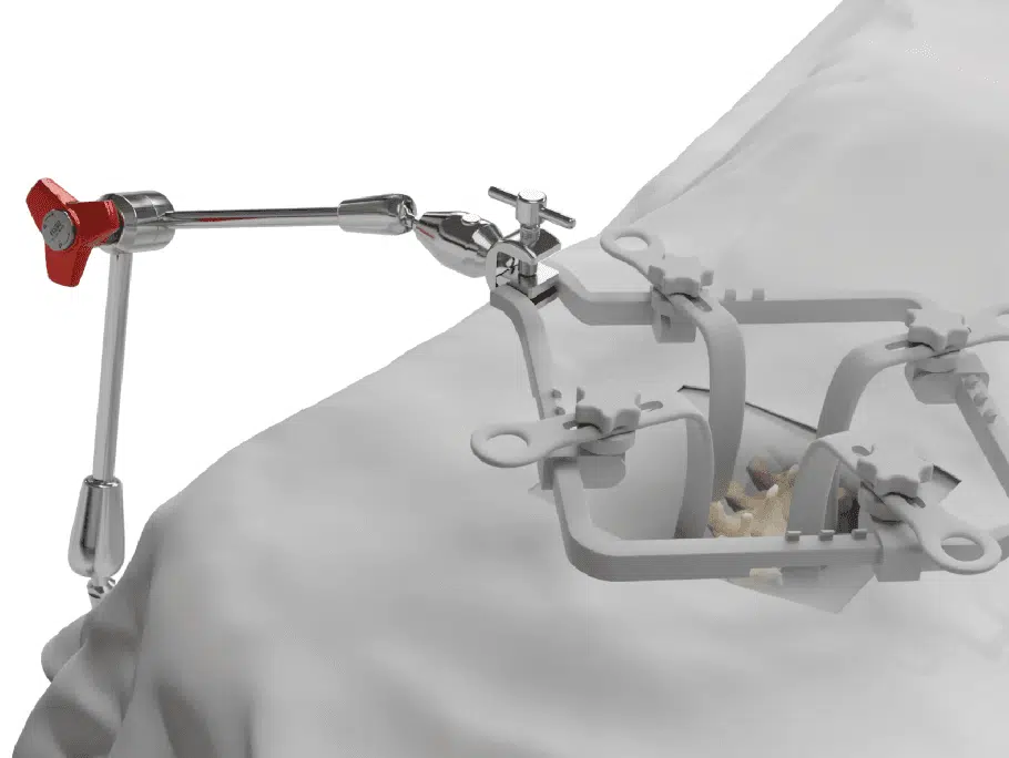 Spine Surgery 14 Screenshot 2025 06 25 at 18.17.44